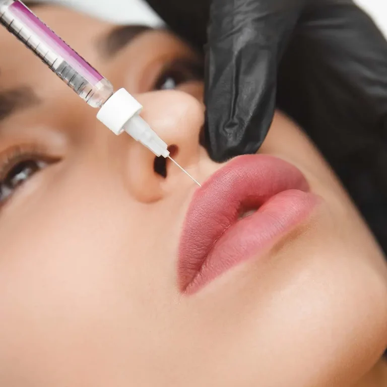 Fillers