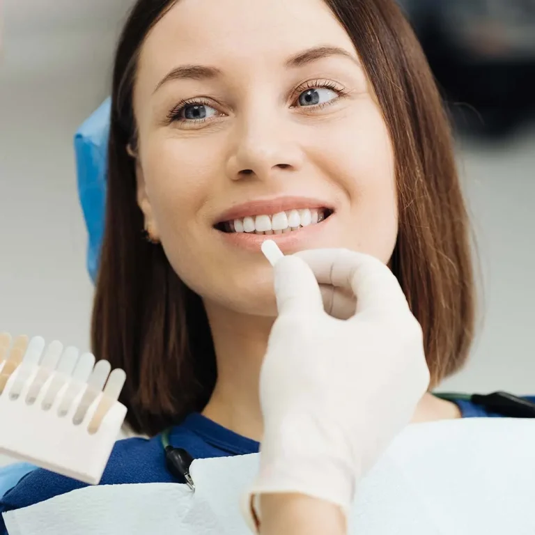Tooth-Whitening