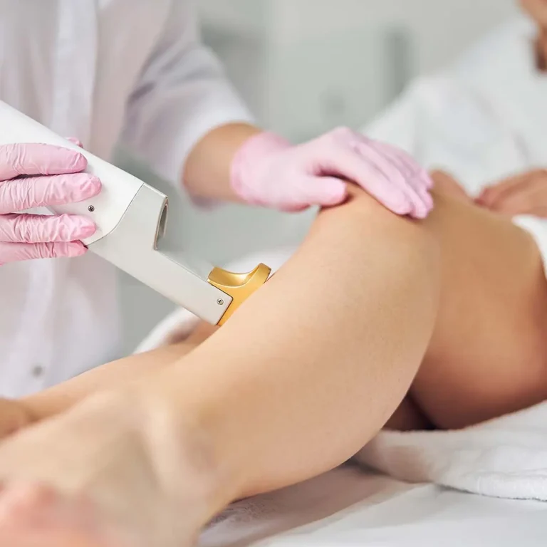 lazer-hair-removal